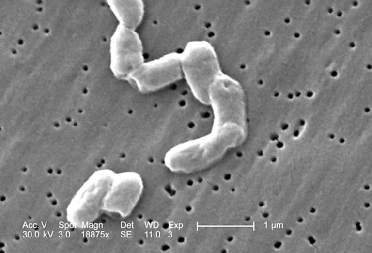 Rod-shaped Gram-negative Salmonella infantis bacteria revealed in the scanning electron microscopic (SEM) image, 2005.