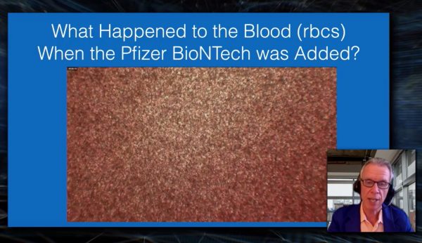 Kevin McCairn's blood after adding the Pfizer-BioNTech vaccine, showing evidence of oxygen desaturation.