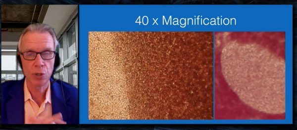Kevin McCairn blood 40x magnification with Pfizer-BioNTech vaccine