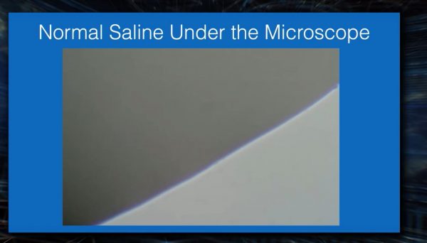 Normal saline solution under microscopy, for contrast and comparison’s purposes.