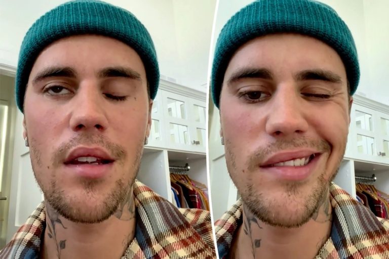 Was Justin Bieber's facial paralysis caused by the COVID vaccines? It's hard to say, but not out of the question.